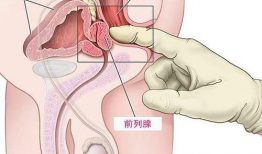 前列腺按摩视频,专业视频解析与操作指南